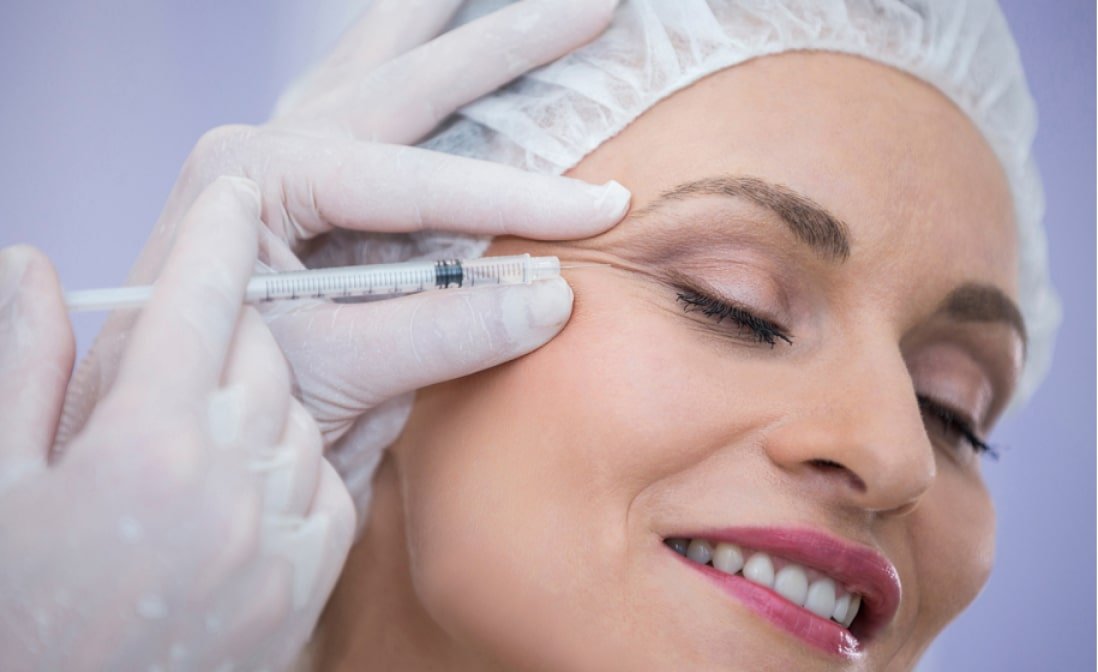 Botox Recovery Timeline: Aftercare, Healing Steps, and Expected Results